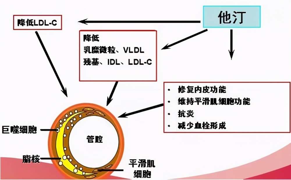 华西杨庆:进口他汀太贵,能换成便宜的吗?