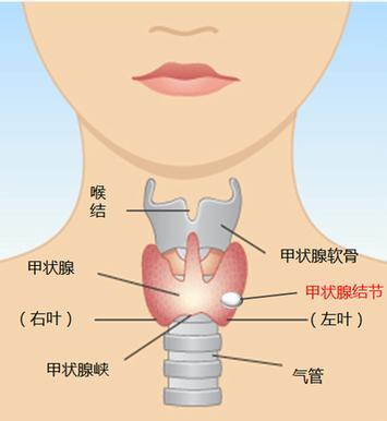 如何预防甲状腺疾病呢?