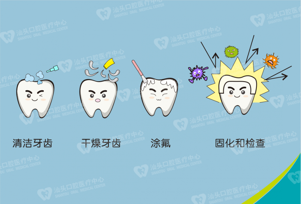 涂氟步骤是什么?