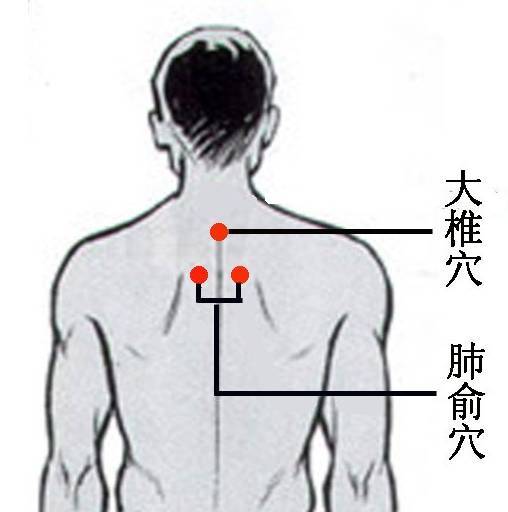 大人或者小孩发烧艾灸哪个部位退烧