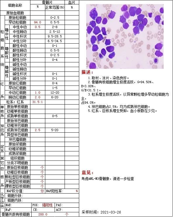 apl?还是mds?千变万化的骨髓细胞