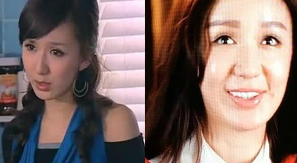 整容毁了多少童年女神,萧蔷王祖贤娄艺潇,面目全非成毁容
