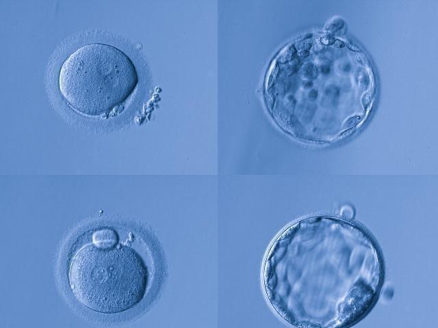 女人卵泡越大越好吗做好3件事或许提高卵子质量有助受孕