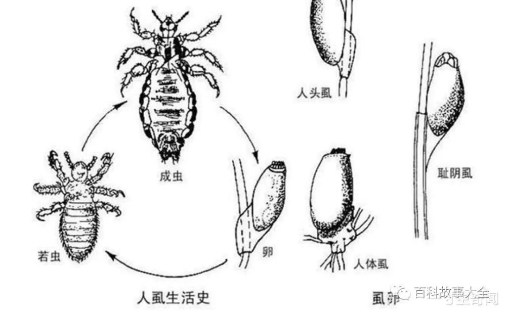 三十年前,几乎每人头上身上都有的虱子,为何突然间消失不见了?