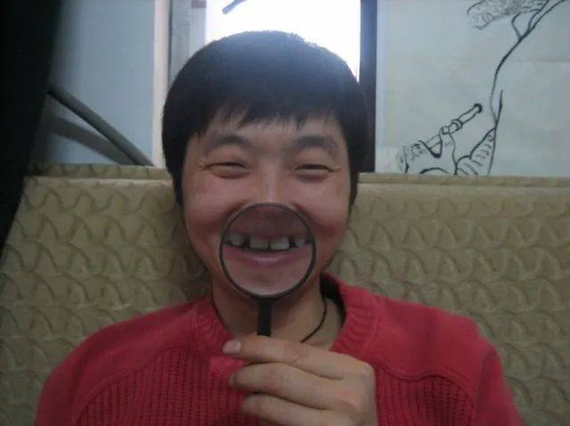 张嘴就是吓人,没想到最拉跨明星们颜值的,是一个人的牙