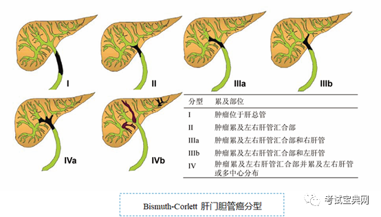 胆道系统肿瘤胆管癌