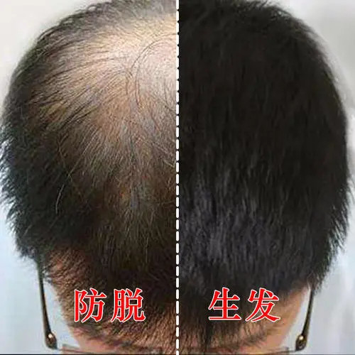 如何生发最有效?