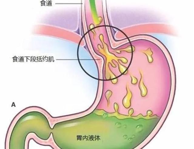 胃部为何总是隐隐作痛?