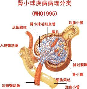 疾病专题直播肾小球疾病的概述