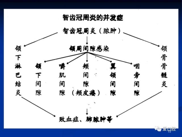 智齿冠周炎