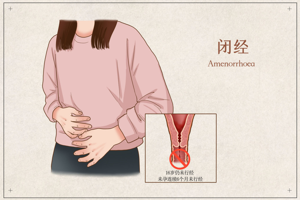 月经出现这些变化是闭经的前兆治疗闭经可以遵循这3步