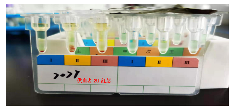 拨开层层云雾,竟是"ta"在干扰交叉配血