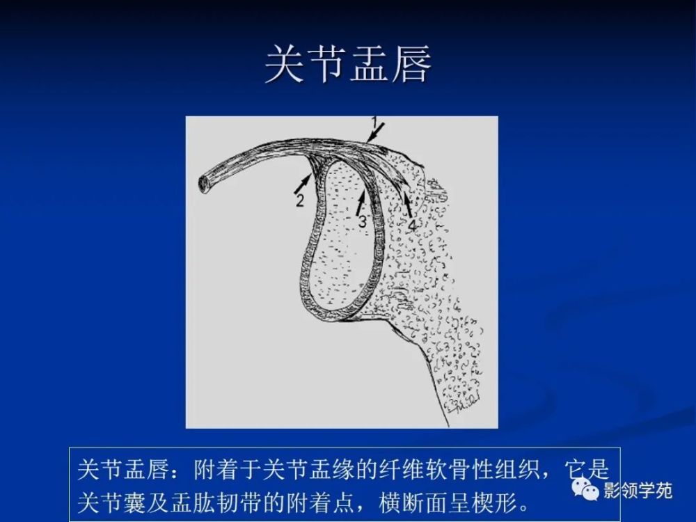 肩关节盂唇损伤的mri诊断