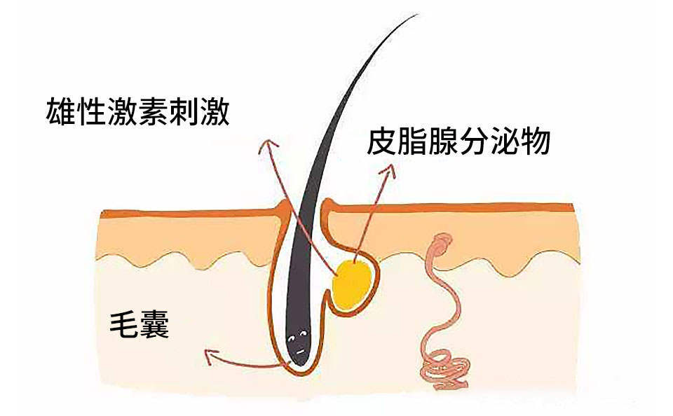 枕什么眠成语_成语故事手抄报(2)