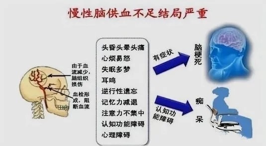 你是否也有脑供血不足?