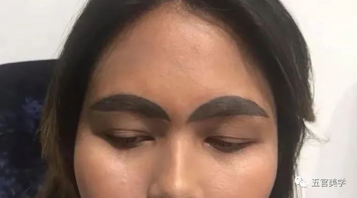 刚做了眉毛的 一定要看!重点在第8项