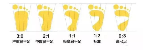 足弓是人类脚的重要结构,有了足弓,足便富有弹性.