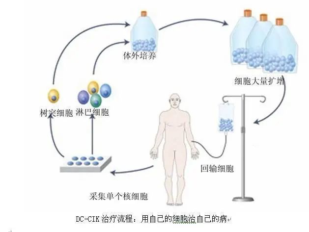 免疫细胞治疗|免疫治疗靠什么延长癌症患者生命?