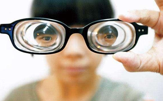 近视往往眼轴会更长,一般近视每增加300度,眼轴增长1mm