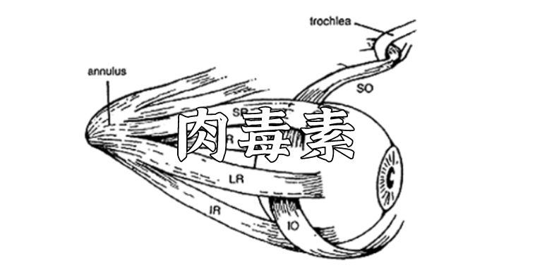 肉毒素最早被用来治疗斜视?这些意外发明刷新了认知!