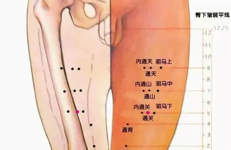 董氏针灸治疗心脏病奇效之穴:三才穴