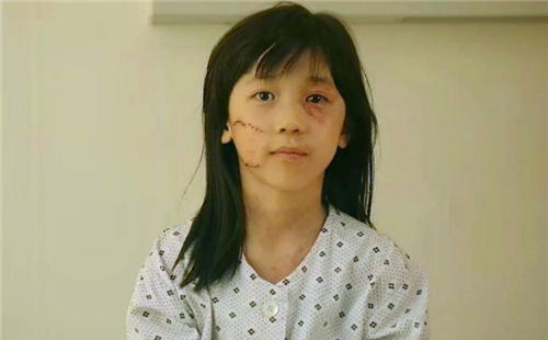 素媛原型8岁女童被人施暴到靠尿袋生活凶手却在今年出狱