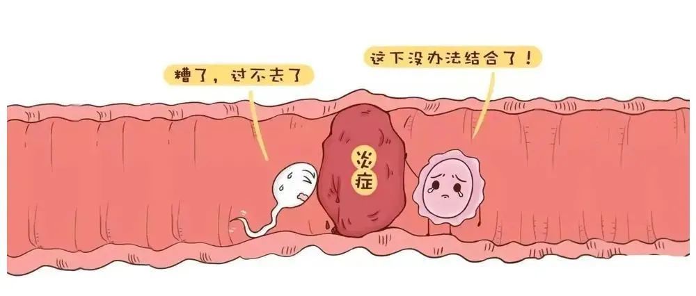 我没做过人流为何输卵管堵塞了