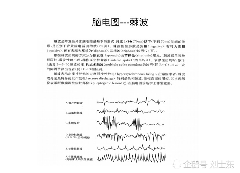 儿童脑电图基础与判读解析