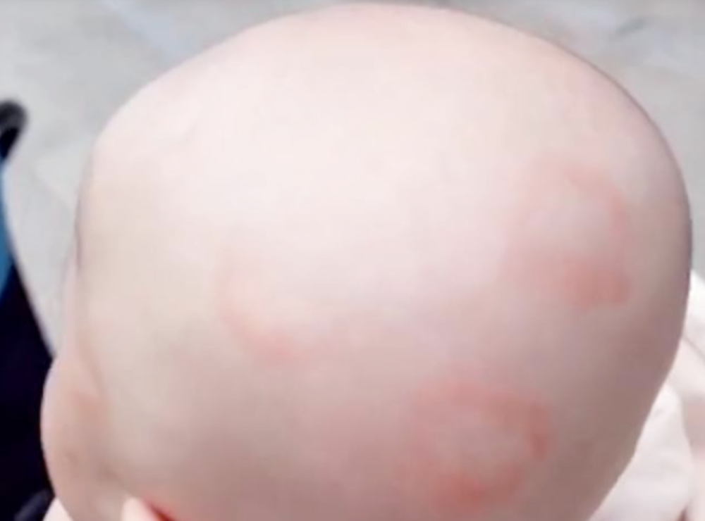 1000