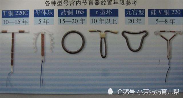 30年过去了,当年第一批"上环"的妈妈们,如今身体如何了?