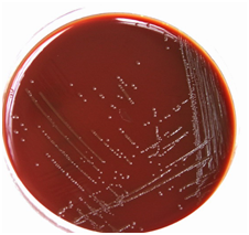 流脑细菌在血平板培养基上的样子