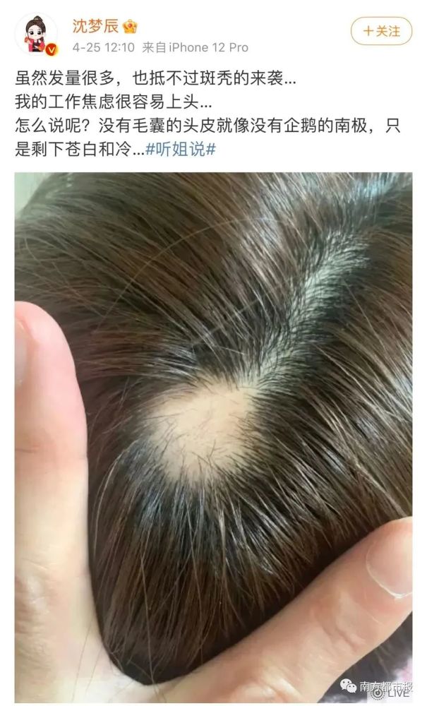 知名女主持自曝"秃头"照,网友纷纷晒同款!很多是年轻人!