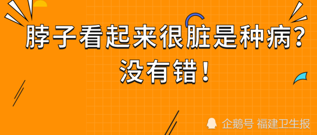 福州男子脖子黑洗不干净遭同事吐槽,医生:这是疾病向你发出信号!