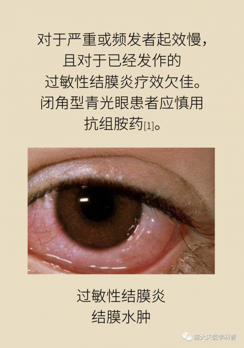 花粉满天飞眼睛痒,小心是过敏性结膜炎