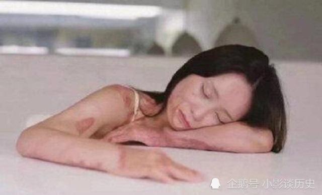 一名男生在上课期间将硫酸泼到了三名女学生身上,致使三人全身大面积