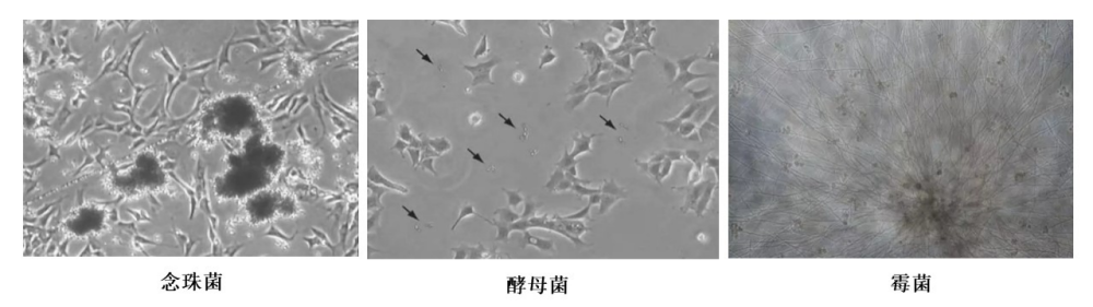 实验室污染的真菌一般为三类: 念珠菌,酵母菌,霉菌,细胞污染真菌通常