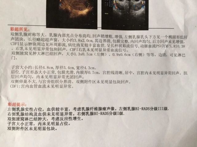 "我才25岁,已经没有资格买保险了.