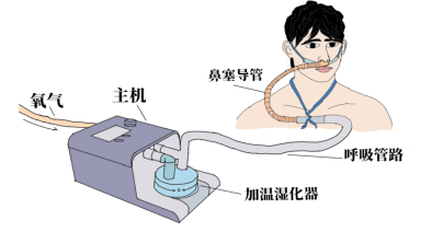 氧疗装置到底该怎么选氧流量怎样设置你的做法很可能是