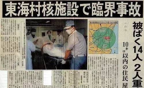 死法最痛苦的日本人:近距离遭核辐射后,医生对他强行救治了83天
