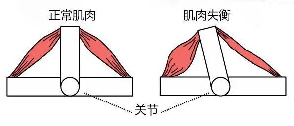 肩关节肌肉失衡的牵伸活动