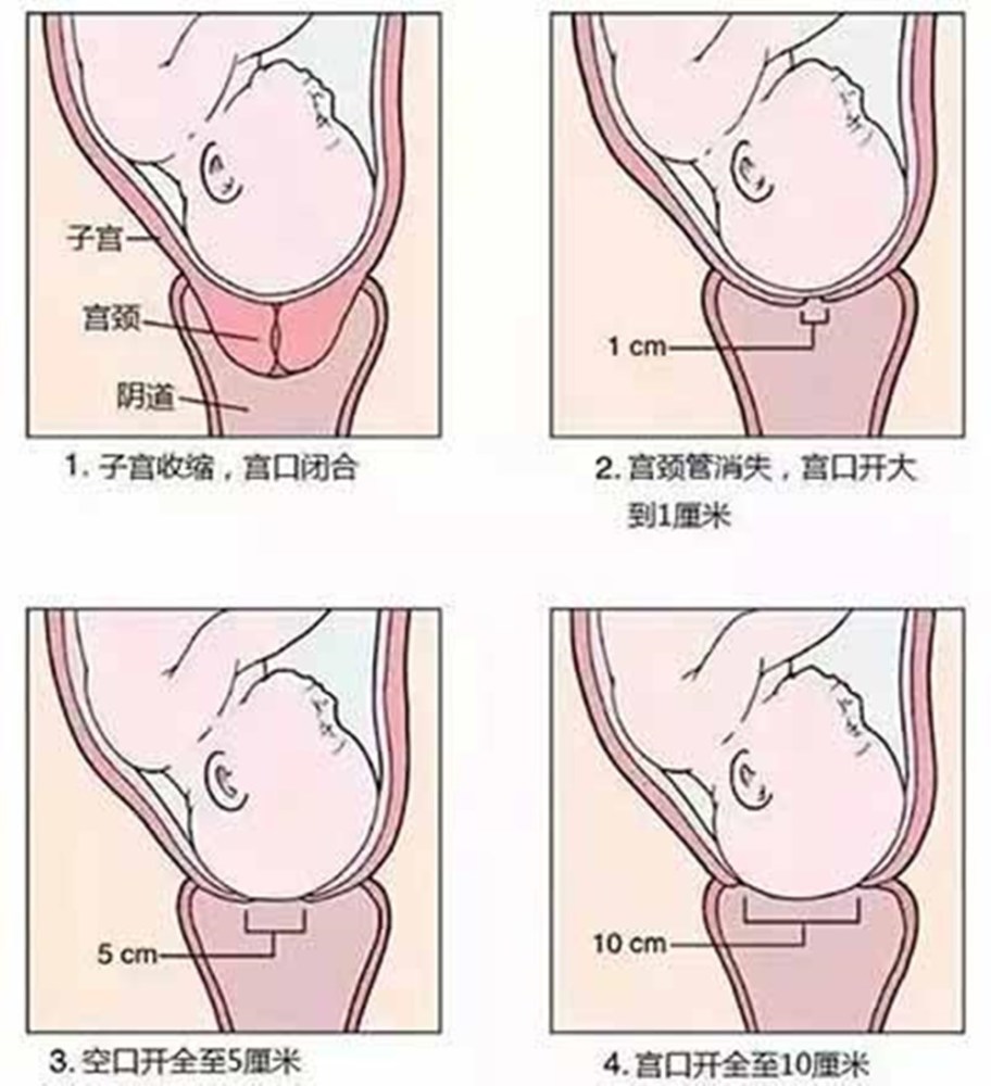 从临产到宫口开大平均需要8小时,而从宫口开大3厘米到开大10厘米平均