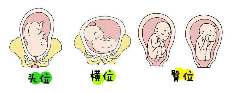 孕晚期胎儿头朝下的姿势不难受吗为和妈妈见面胎儿很努力