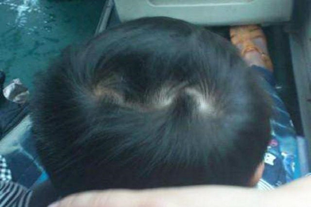 两个旋的娃从小不好管孩子头上的发旋究竟有何影响