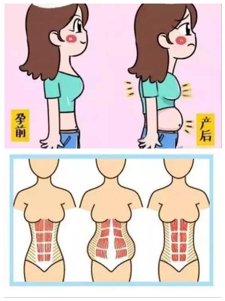 干货丨产后妈妈盆底肌,腹直肌修复指南