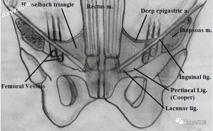 图3. 腹股沟韧带