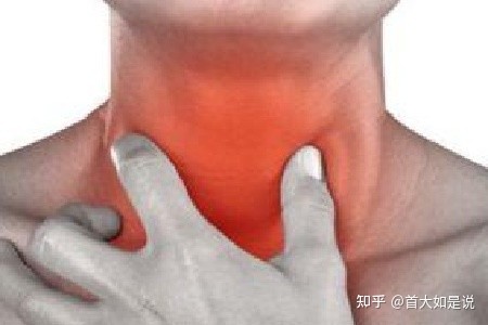 潍坊耳鼻喉医院:喉软骨膜炎的症状都有哪些