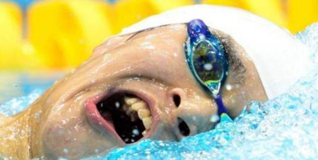 张柏芝摘颊脂垫,吴亦凡整牙槽骨,都是为了解决