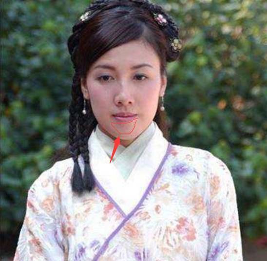 张柏芝摘颊脂垫,吴亦凡整牙槽骨,都是为了解决