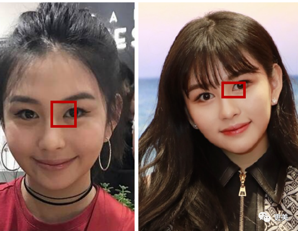 邱淑贞女儿沈月开眼角不慎把自己do成了僵脸娃娃