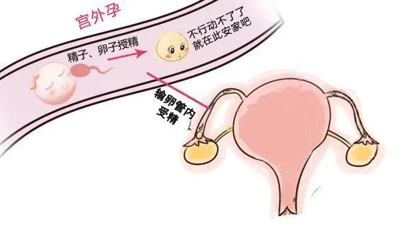 南昌华儿山生殖医院:输卵管通而不畅,还能自己怀上吗?